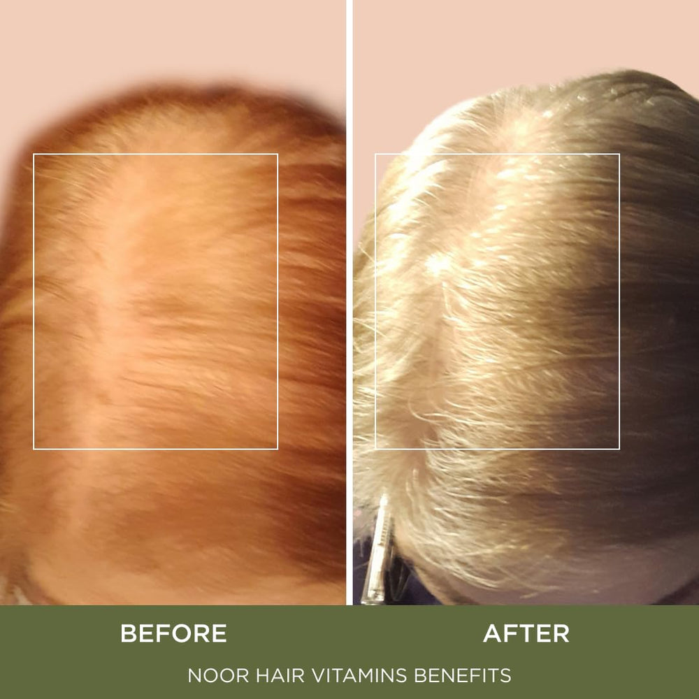 NOOR HAIR caja abierta con cápsulas y fácil dosificación