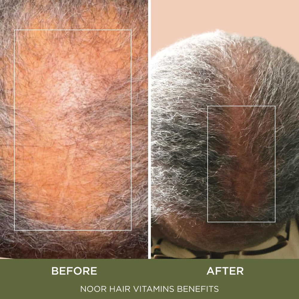 NOOR HAIR comparación de tamaño en mano para visualización práctica
