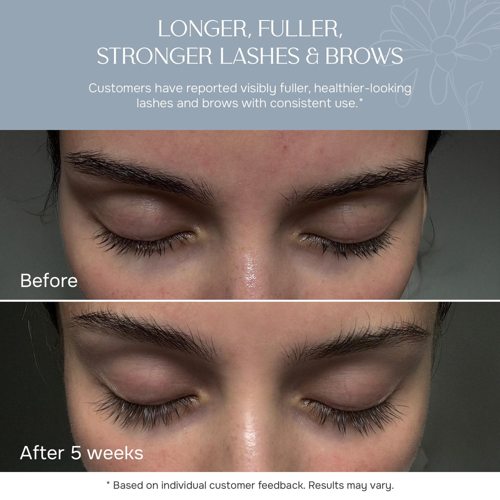 NUNA fine-tip applicator close-up for precise, mess-free application