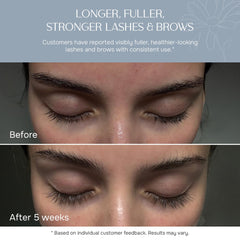 NUNA fine-tip applicator close-up for precise, mess-free application