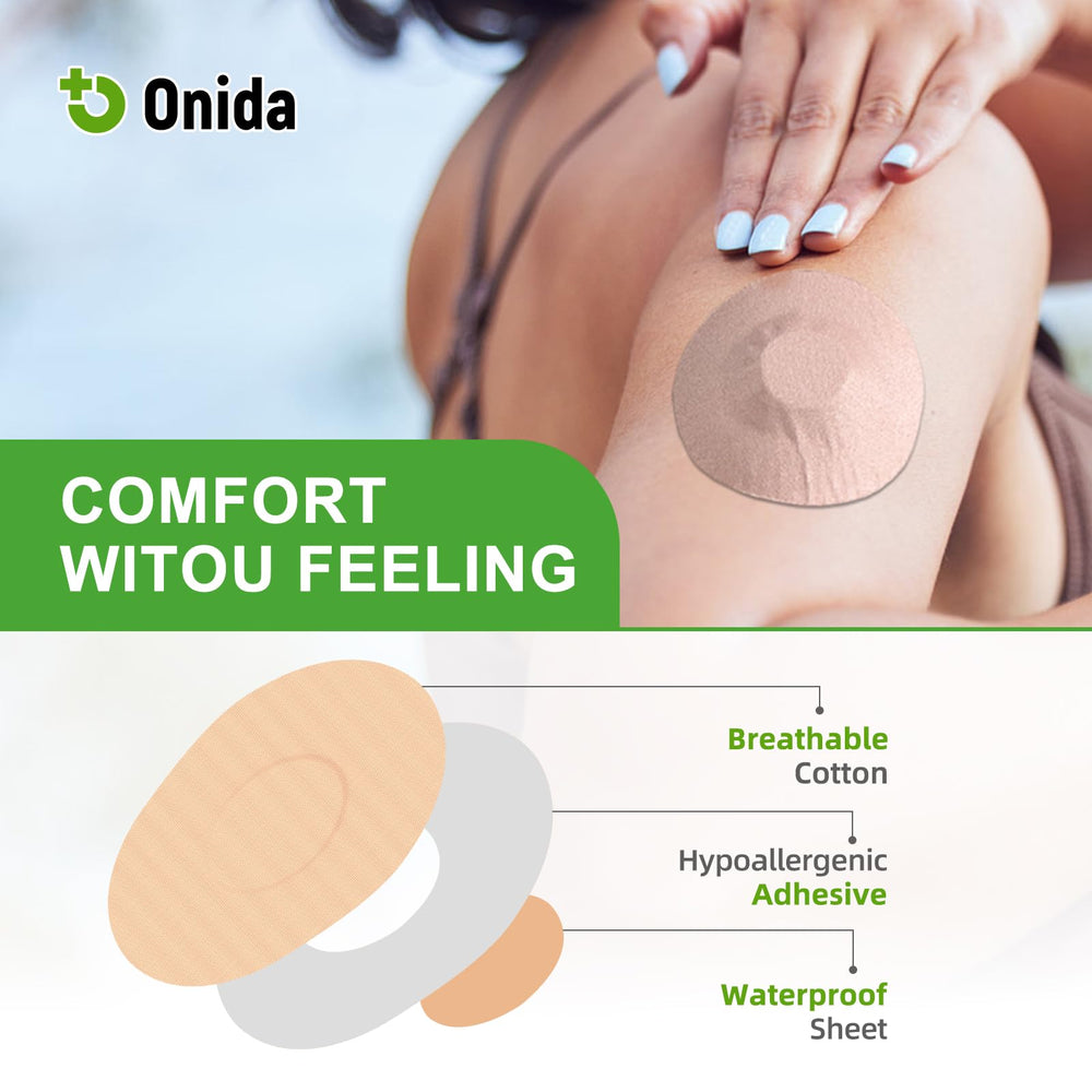 Onida Dexcom G7 parche pegado tras ejercicio, mantiene sensor estable