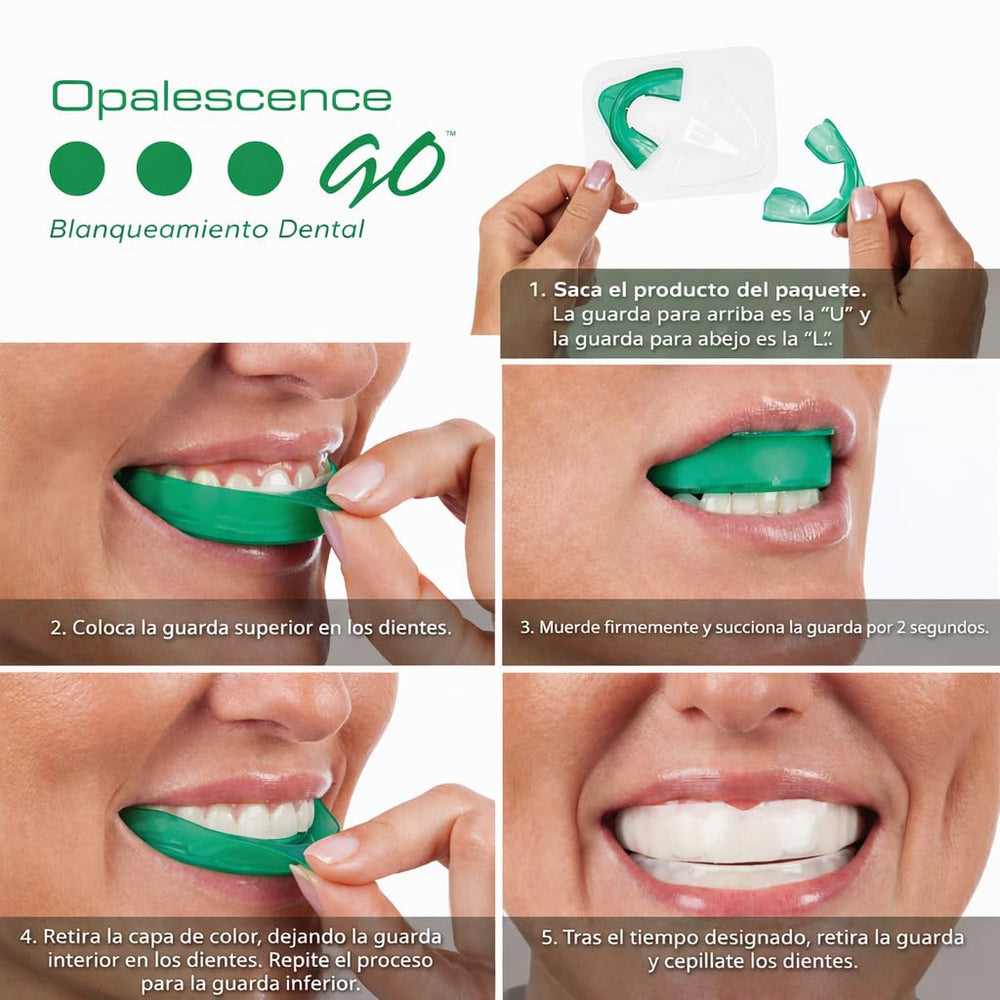 Opalescence bandejas prellenadas cerca para colocación cómoda y rápida