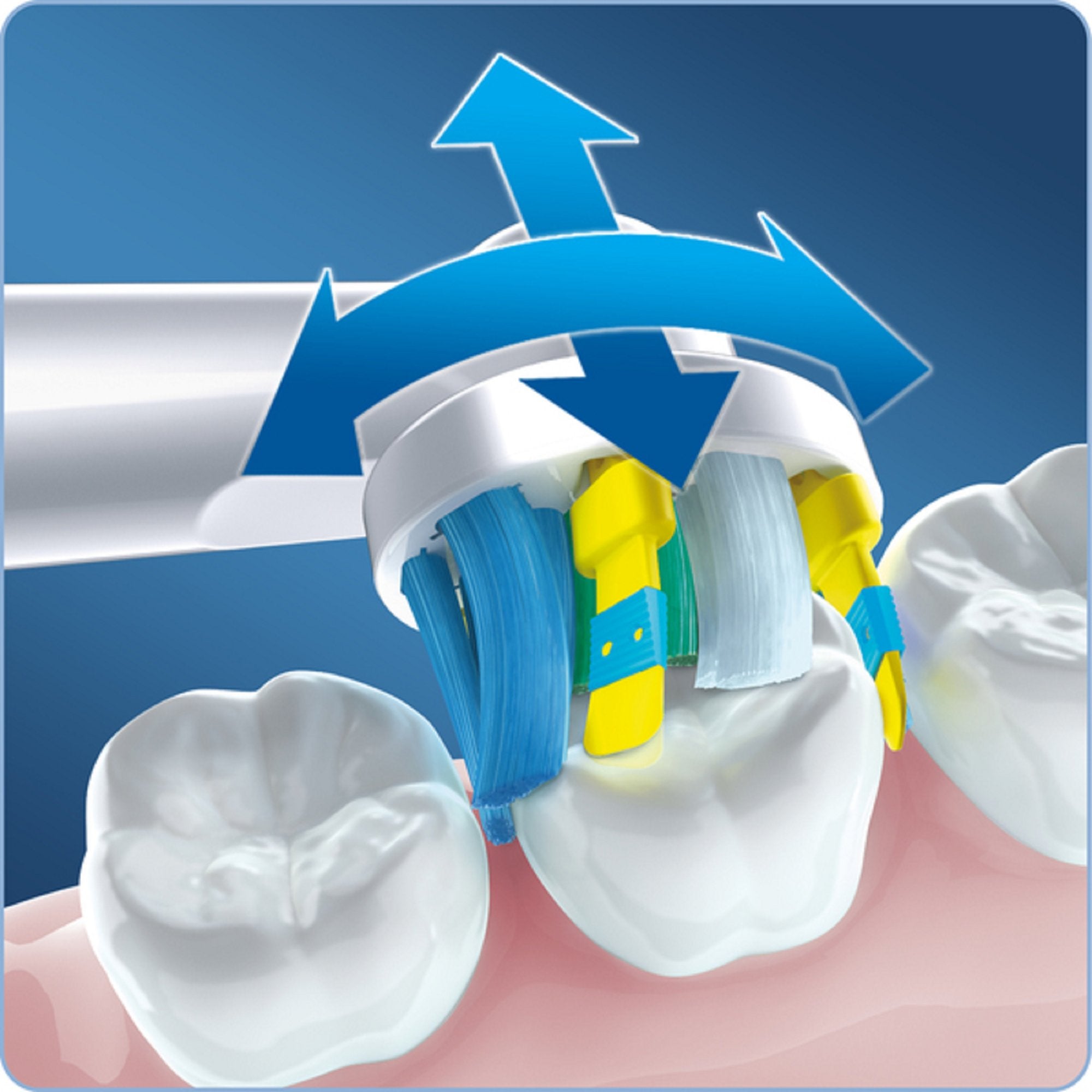 Oral-B cabezal usado sobre modelo dental demostrando eliminación de residuos