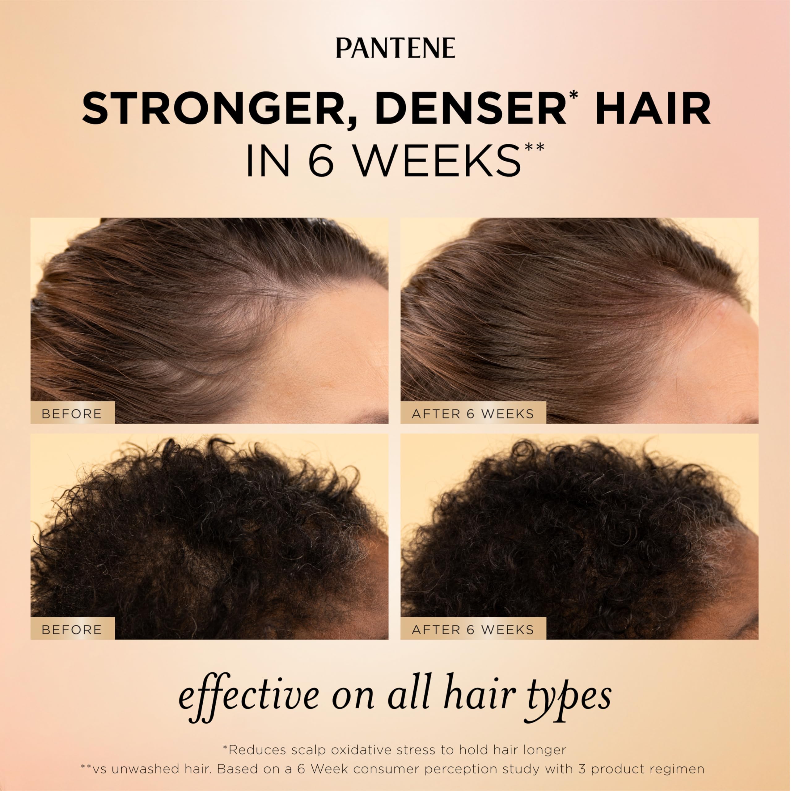 Pantene scalp serum dropper closeup showing targeted root nourishment
