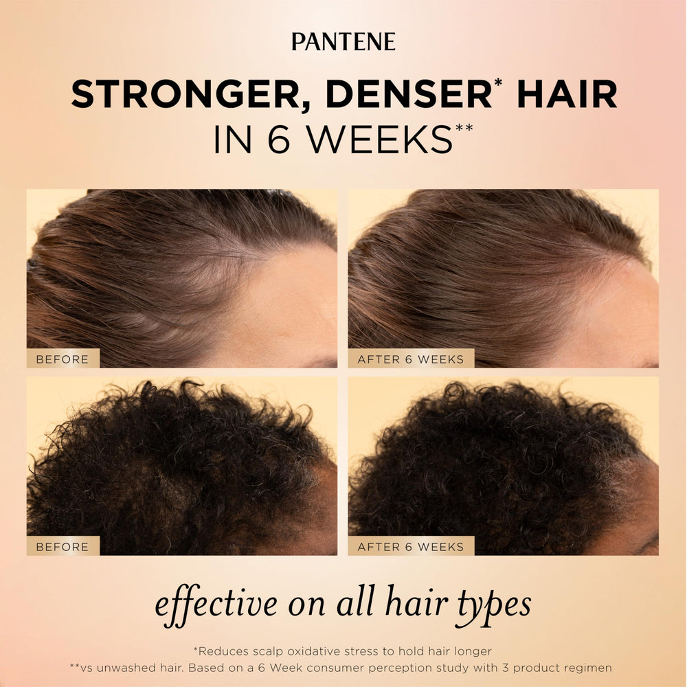 Pantene scalp serum dropper closeup showing targeted root nourishment