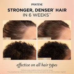 Pantene scalp serum dropper closeup showing targeted root nourishment