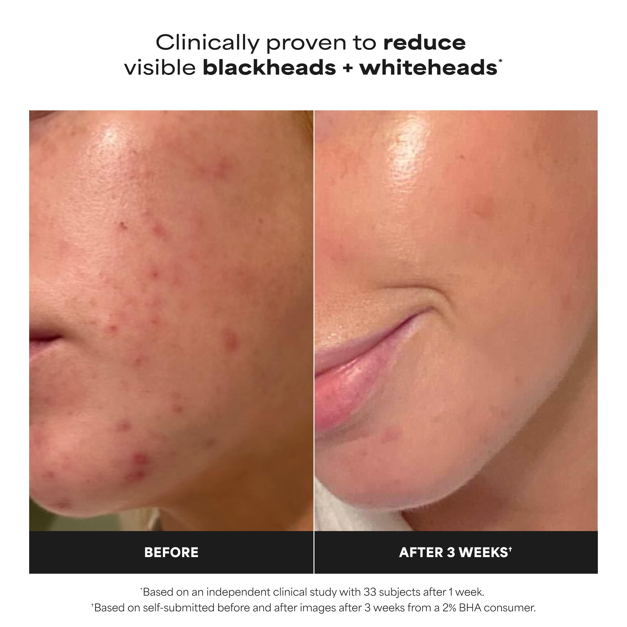 Paula's Choice label close-up emphasizing 2% BHA salicylic acid clarity benefit