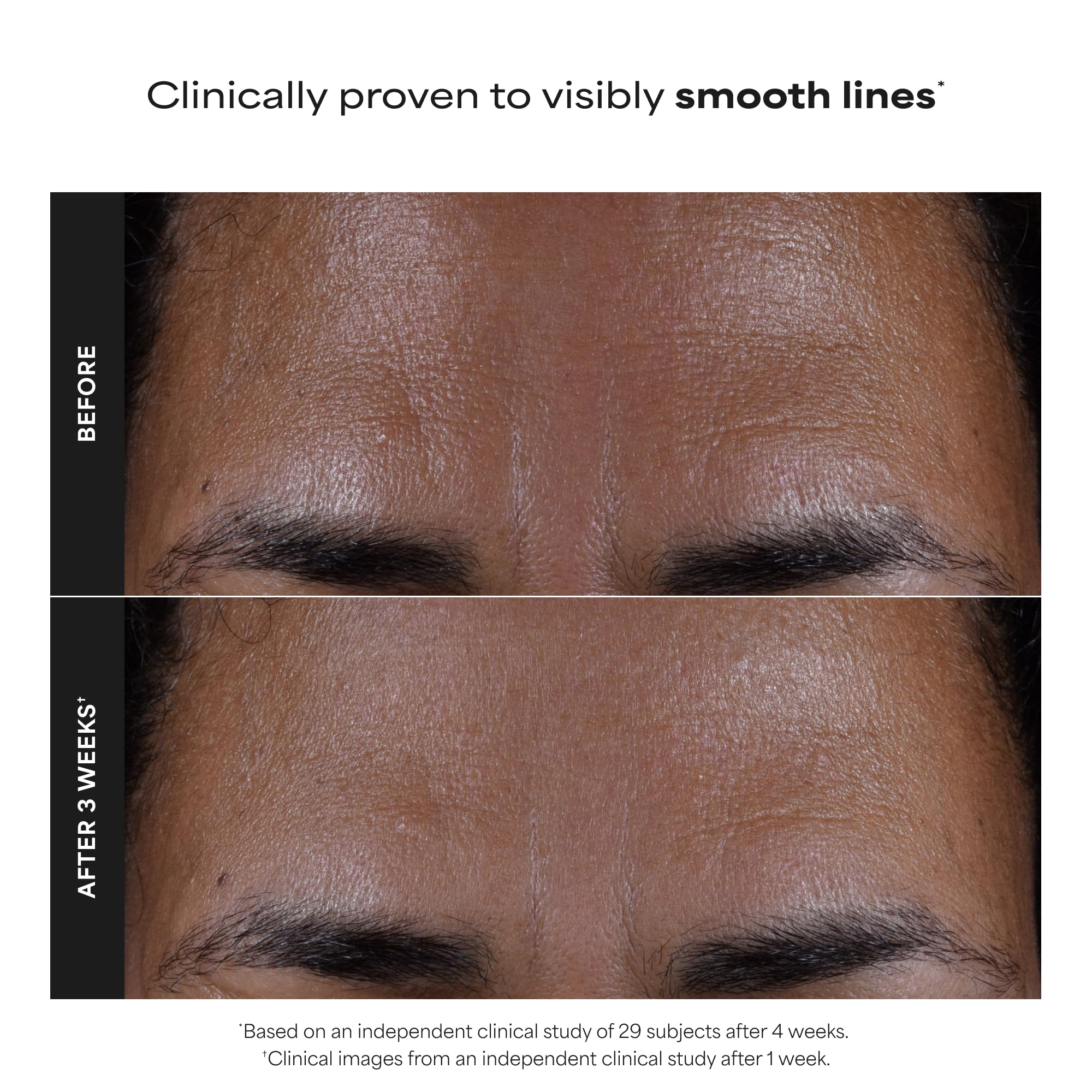 Paula's Choice liquid texture droplet on skin illustrating gentle non-abrasive exfoliation
