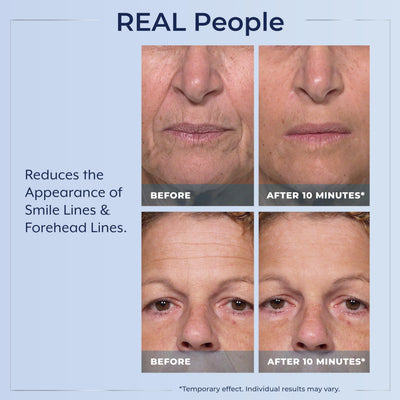 Plexaderm applied under-eye illustrating visible lift and refreshed look benefit
