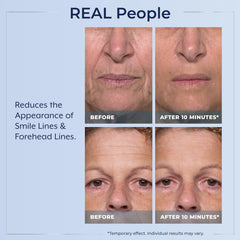 Plexaderm applied under-eye illustrating visible lift and refreshed look benefit