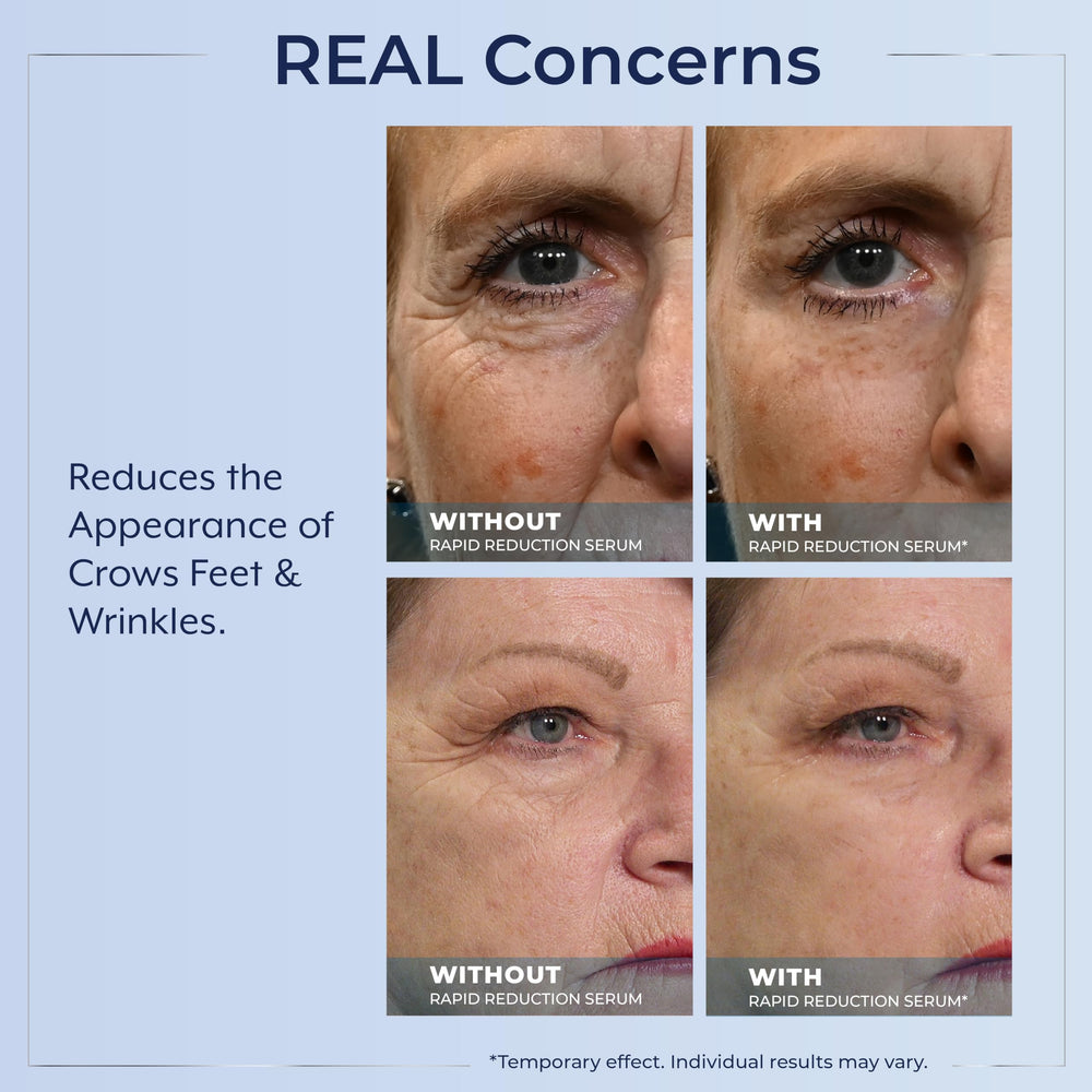 Plexaderm with makeup comparison highlighting seamless blend and natural finish benefit