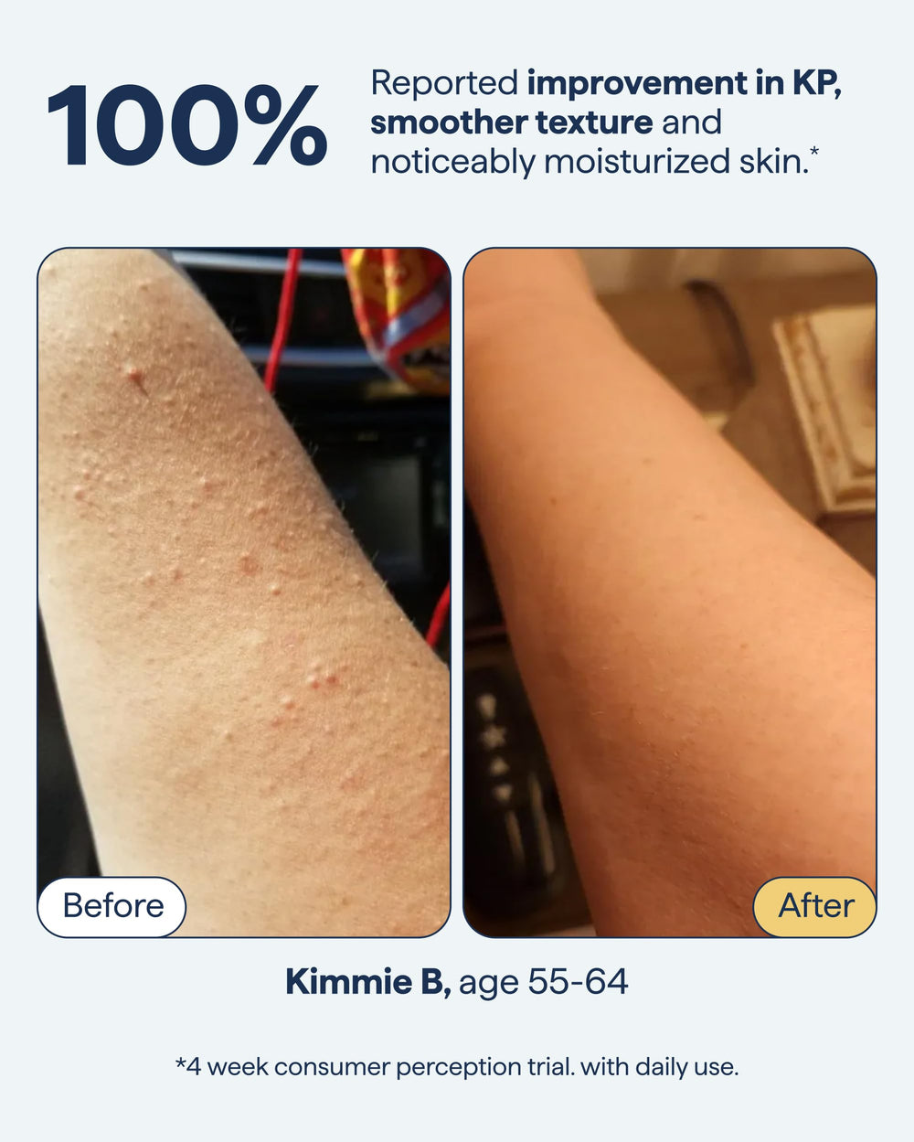 Remedy Science aplicación en brazo demostrando suavidad visible