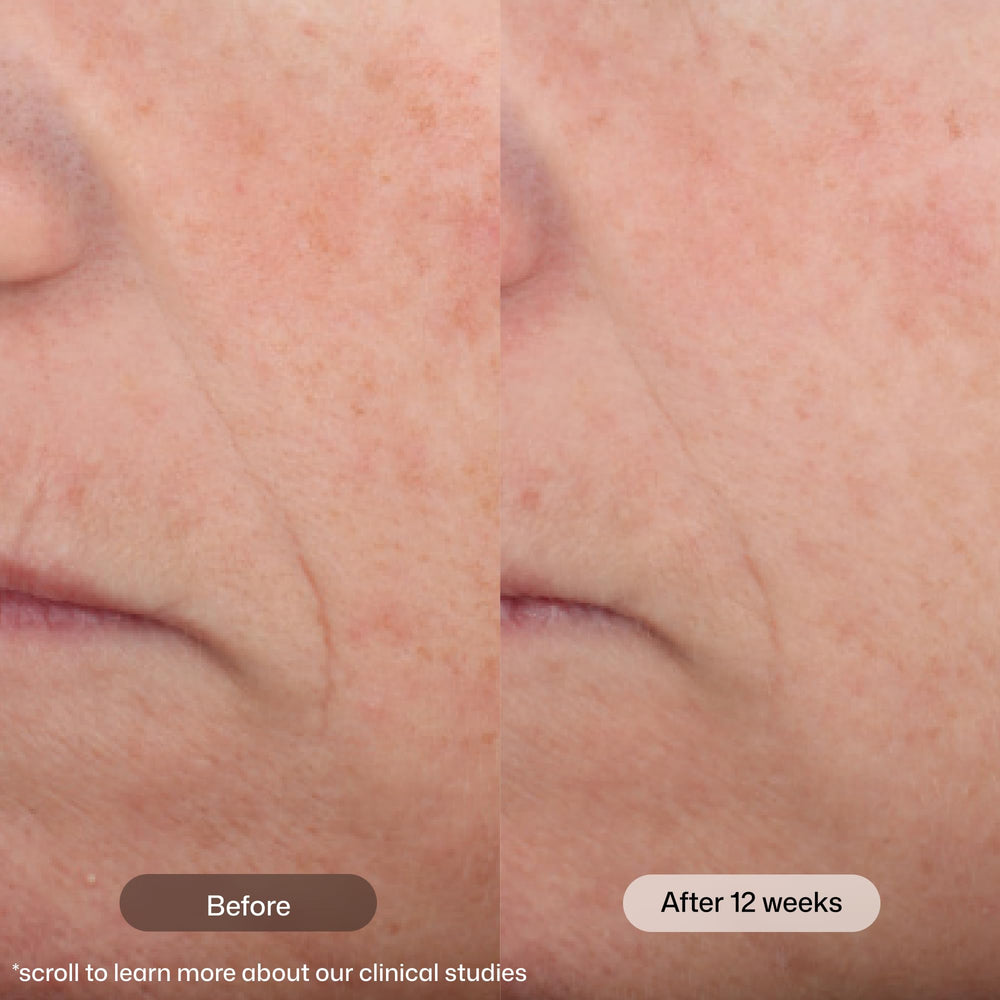 Revision Skincare bote abierto con producto visible, práctico para uso diario