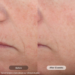 Revision Skincare bote abierto con producto visible, práctico para uso diario