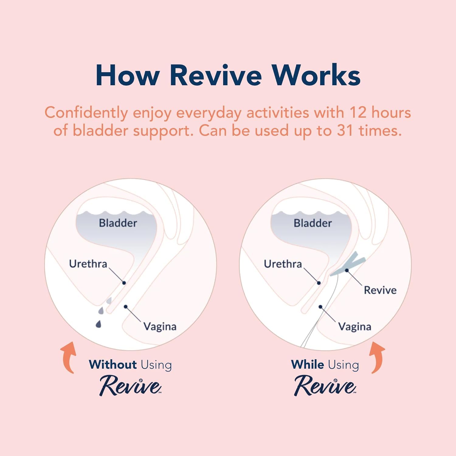 RINOVUM Revive comparación de tamaño para entender escala y facilidad de uso