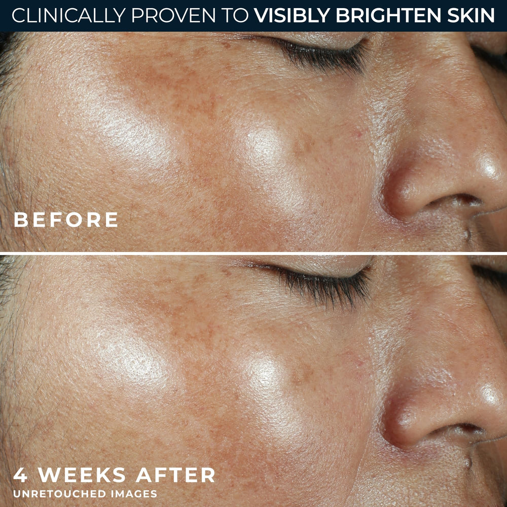 RoC embalaje que incluye sobre de retinol eye cream, beneficio: cuidado extra para contorno