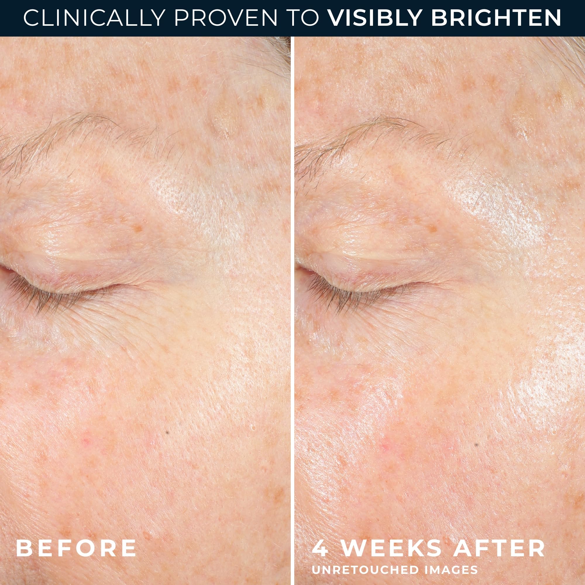 RoC etiqueta con ingredientes clave destacando vitamina C y péptidos para eficacia visible