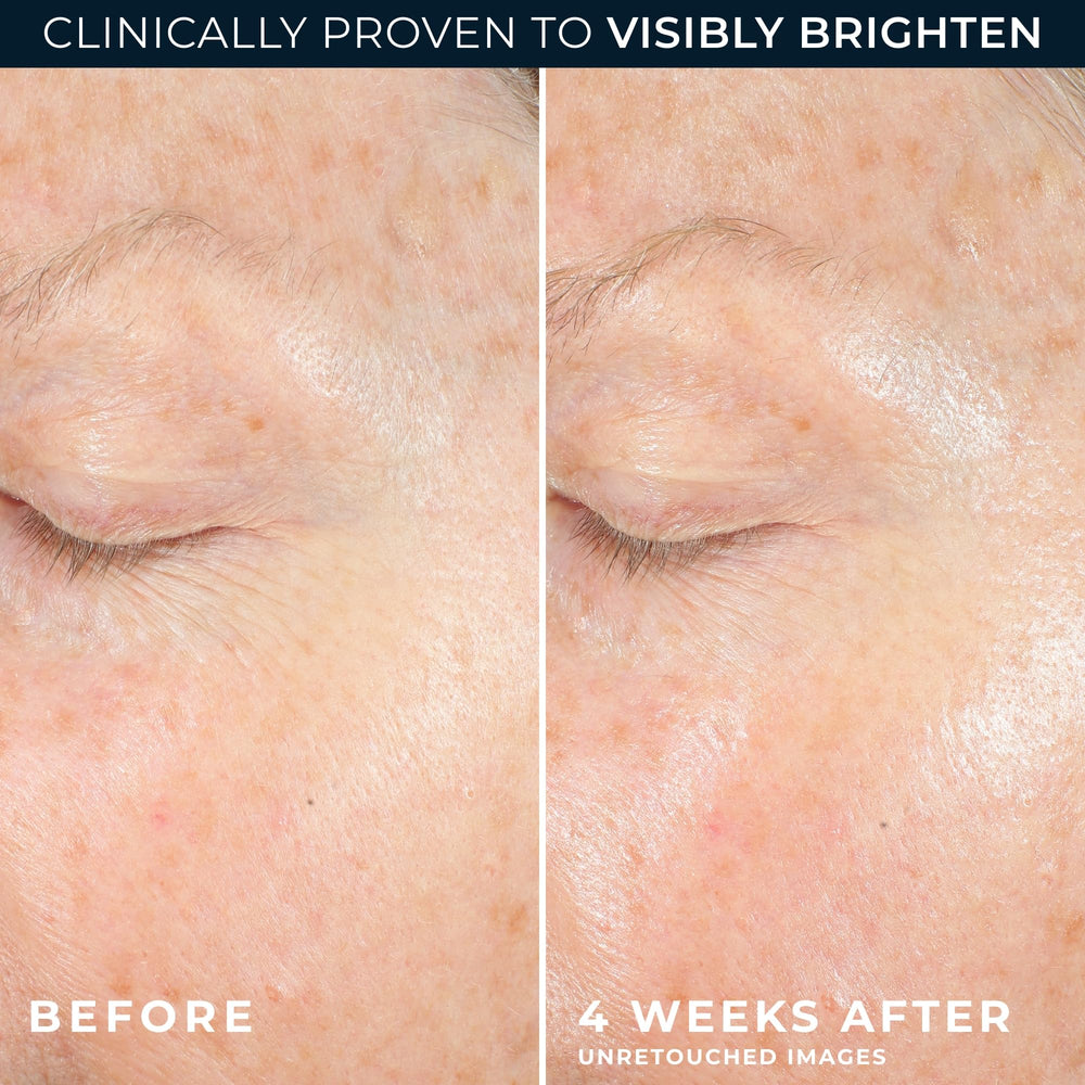 RoC etiqueta con ingredientes clave destacando vitamina C y péptidos para eficacia visible
