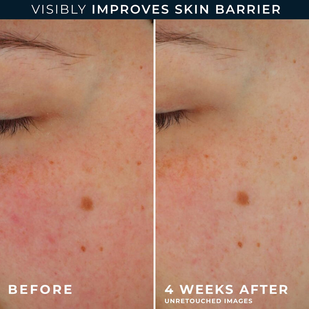 RoC etiqueta con ingredientes destaca ceramidas y prebióticos informativo
