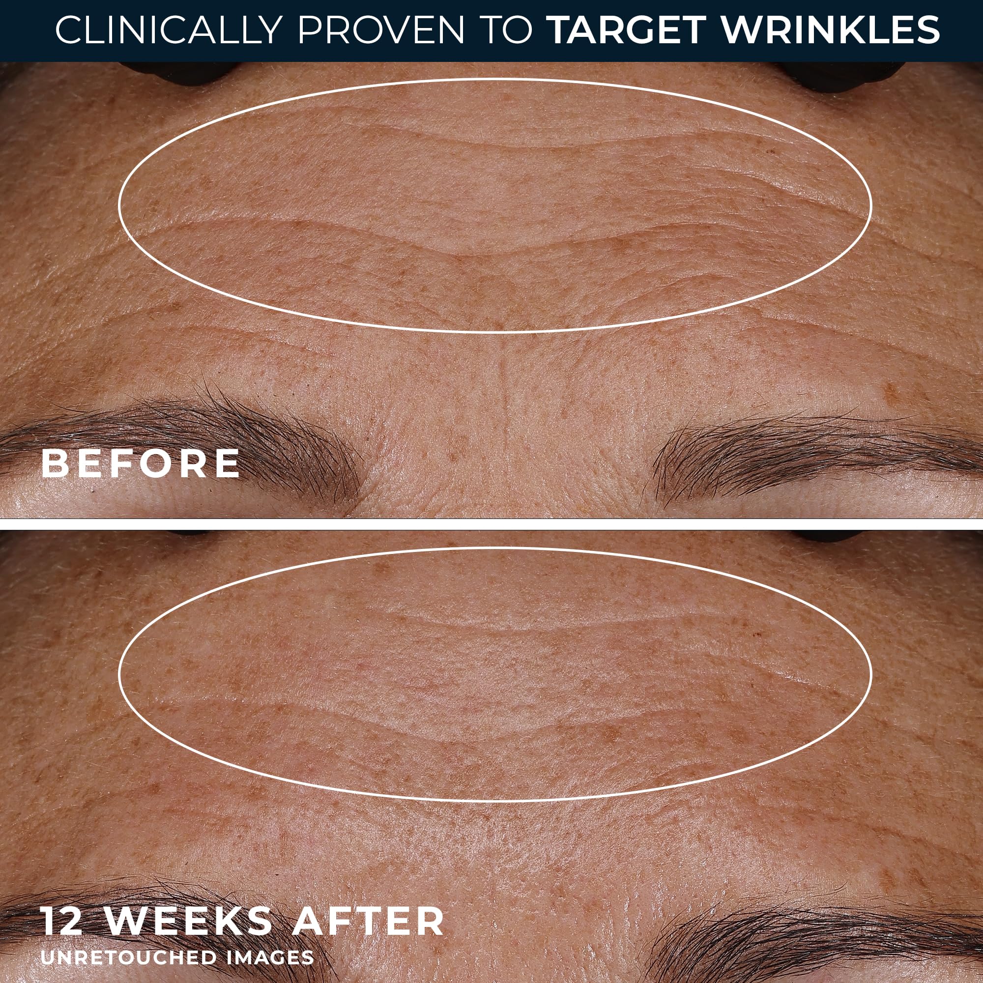 RoC etiqueta con ingredientes y complejo mineral visible