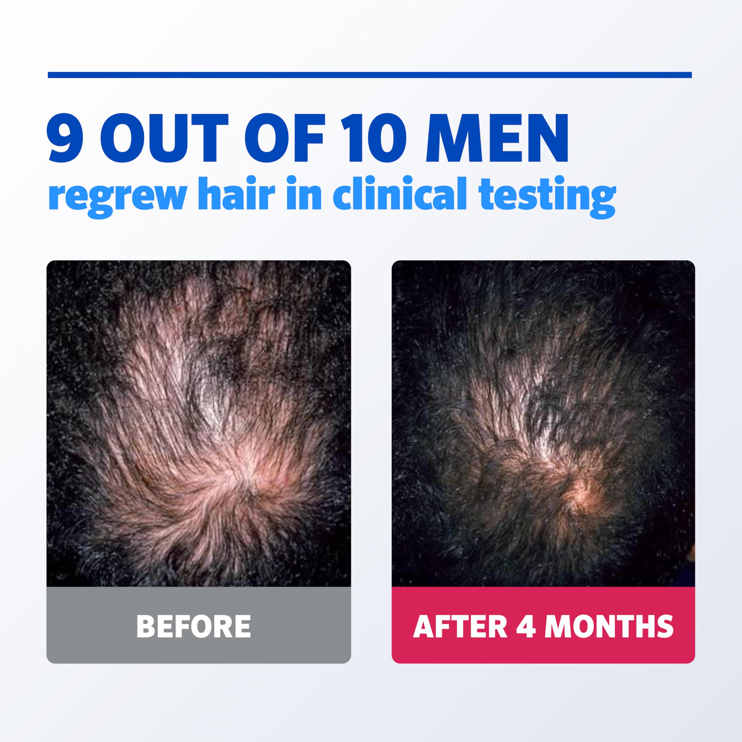 Rogaine etiqueta principal legible, información de minoxidil 5%