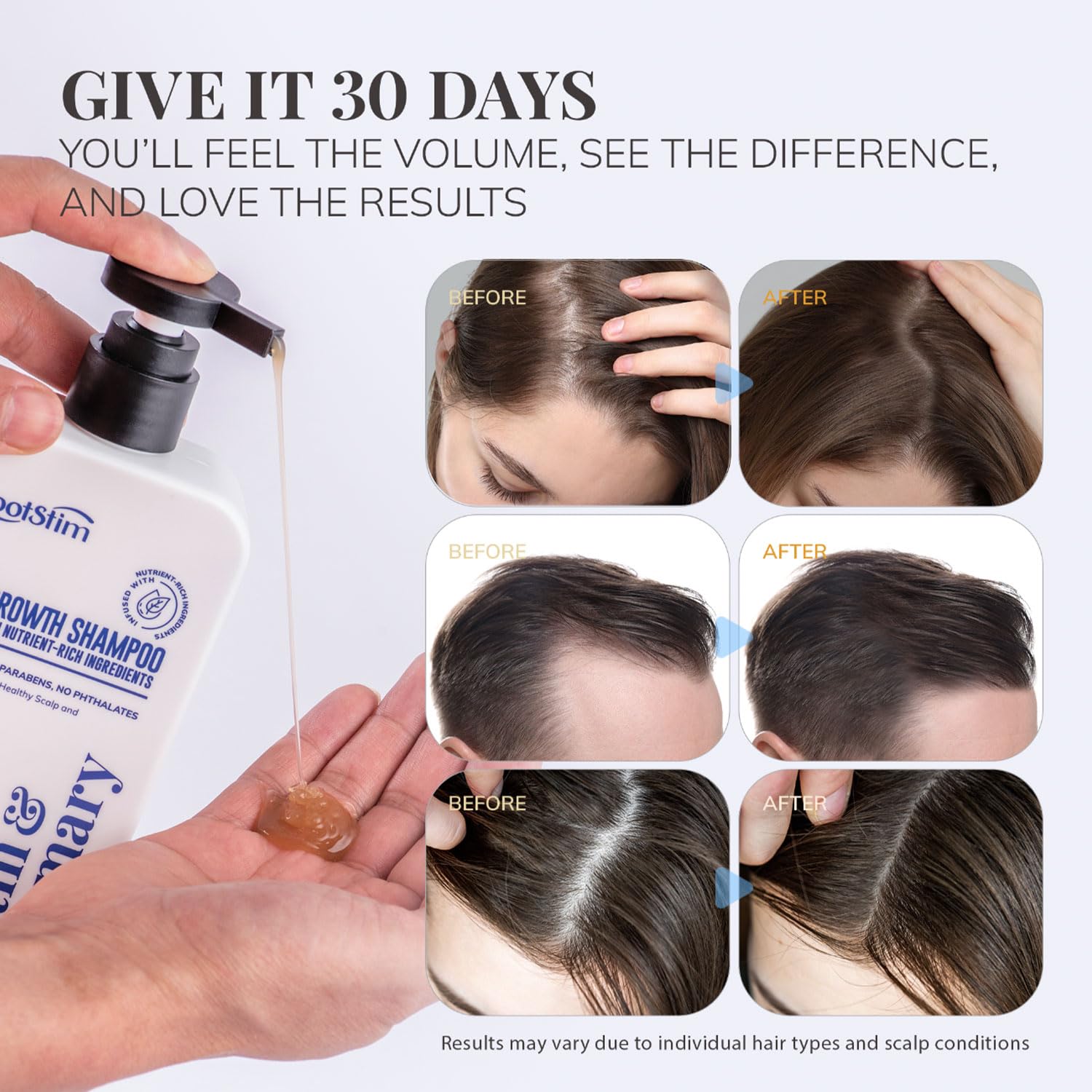 RootStim comparación de tamaño 10 fl oz para visualizar la cantidad real
