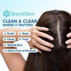 Roycederm aplicación en rostro para calmar enrojecimiento y sequedad