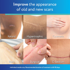 ScarAway surface texture detail highlighting silicone smoothness and protection