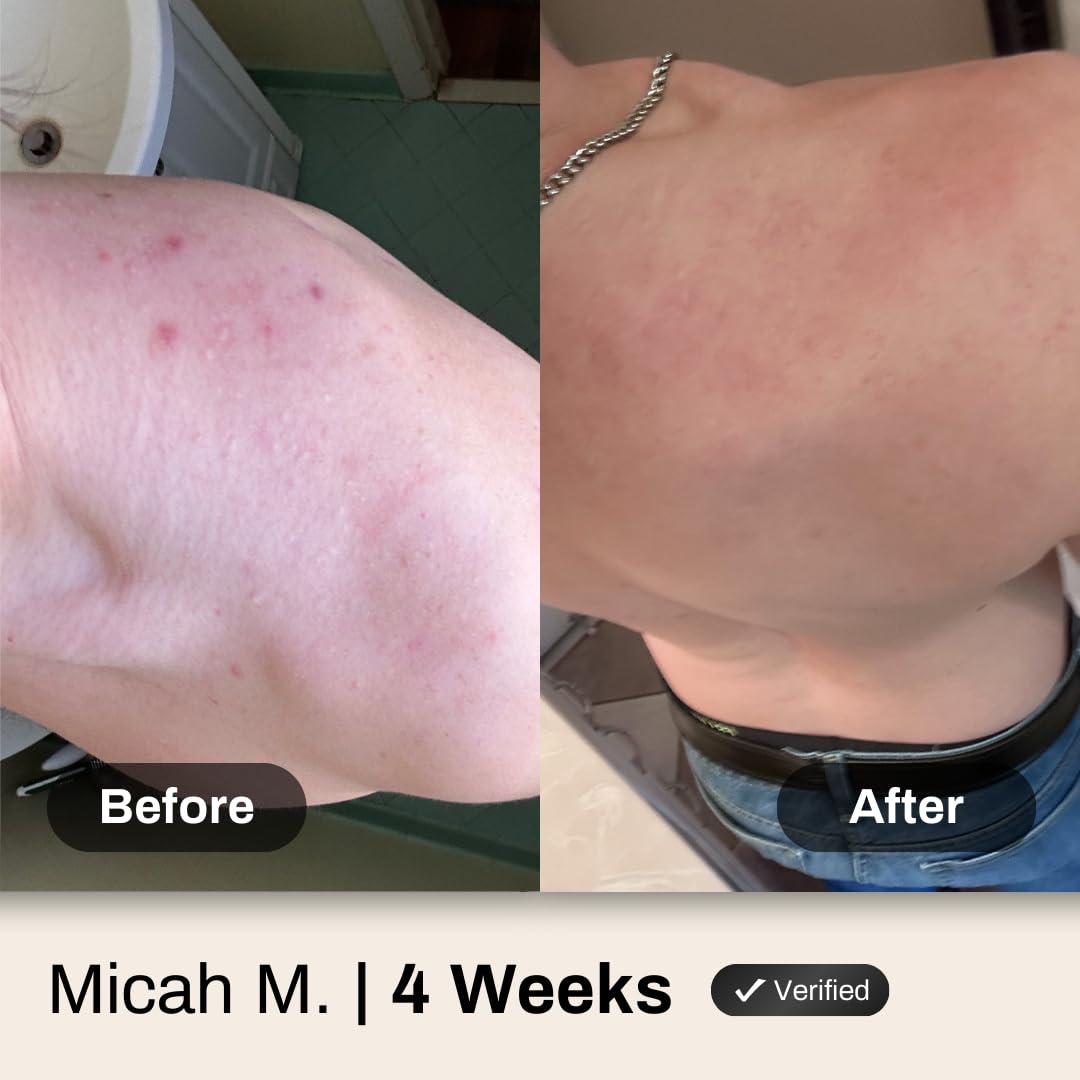 Shield producto en la ducha limpiando espalda después del ejercicio
