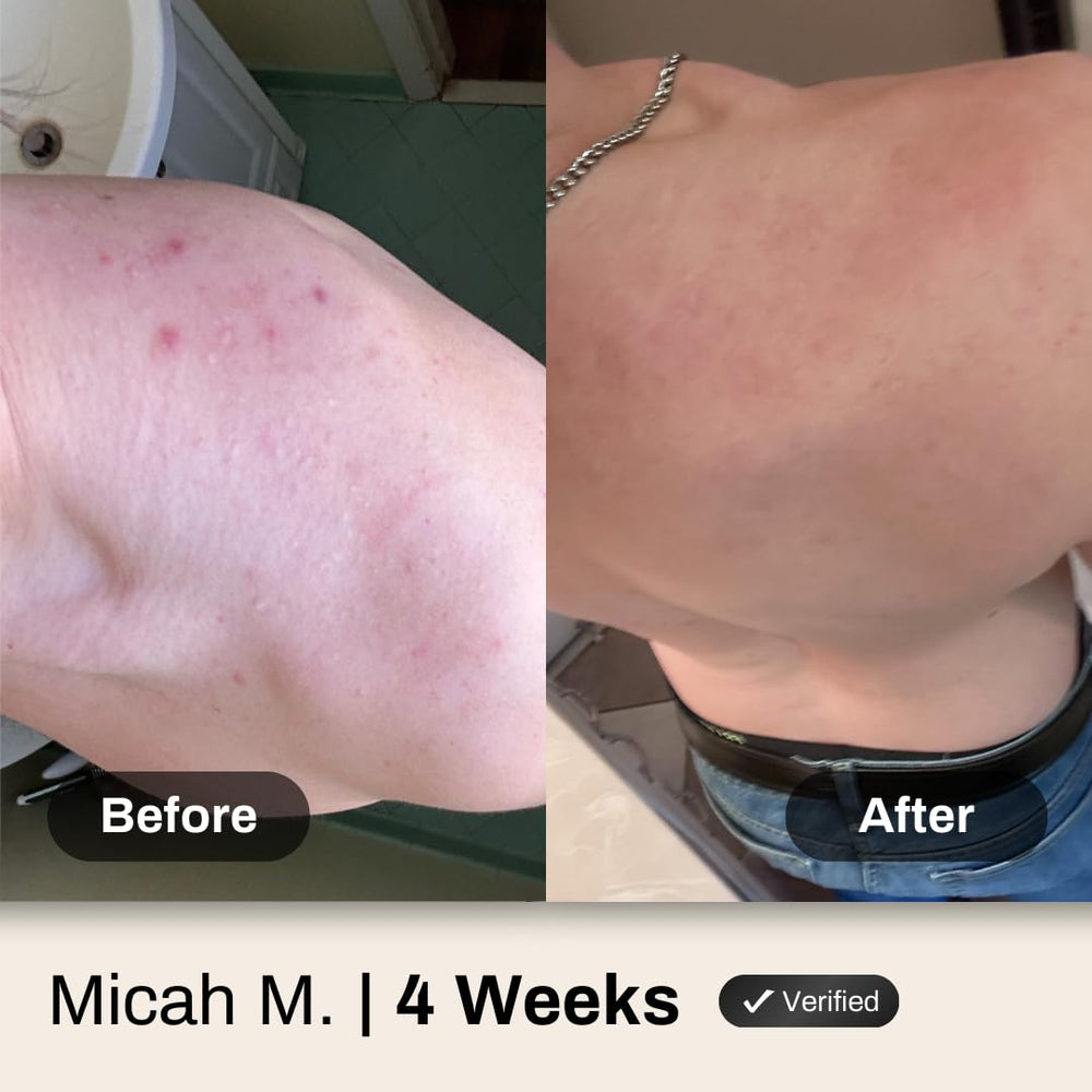 Shield producto en la ducha limpiando espalda después del ejercicio