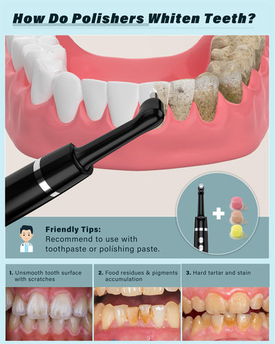 Smile-Aid kit accessories laid out including five heads and three pastes for versatile polishing