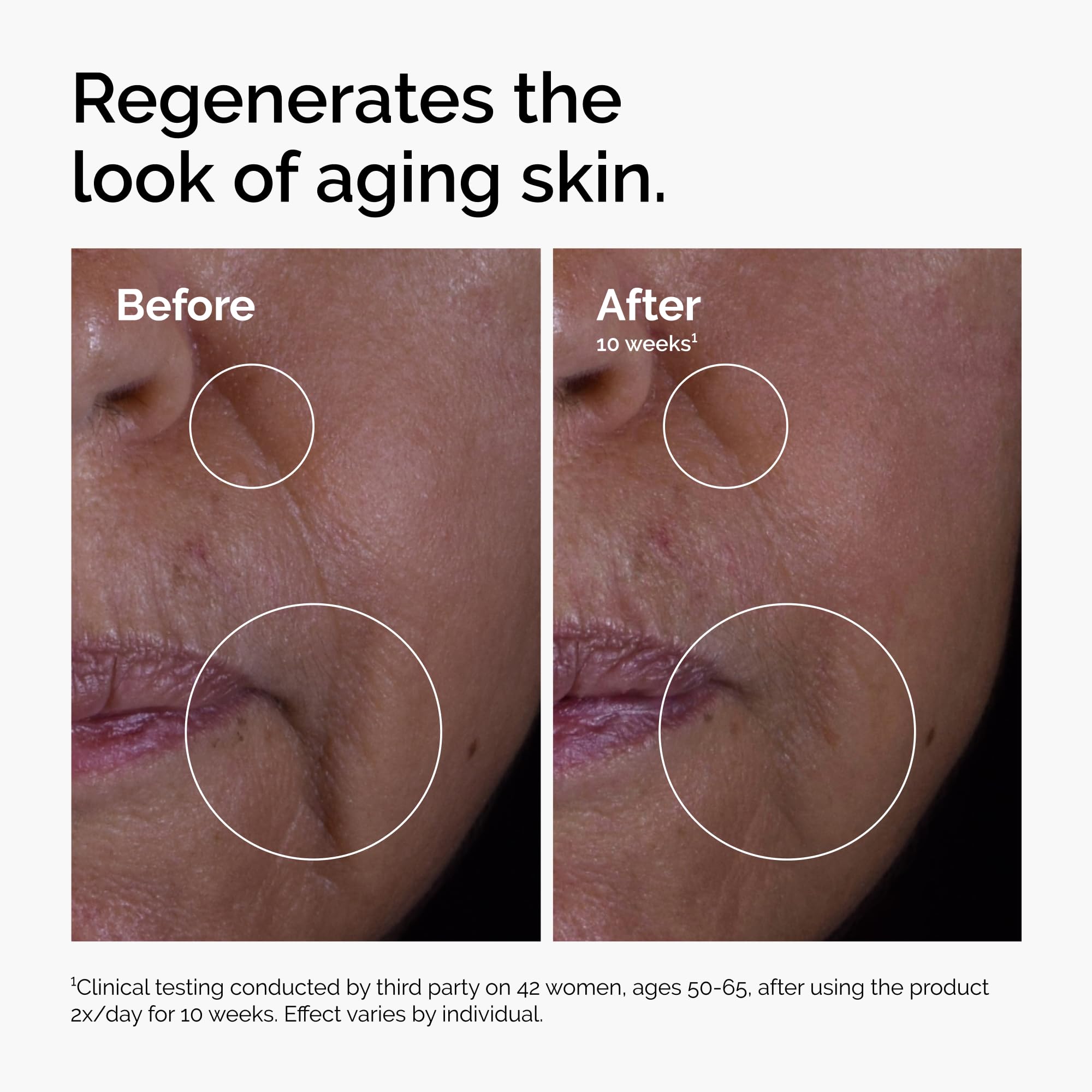 The Ordinary etiqueta con lista de ingredientes clave transparencia