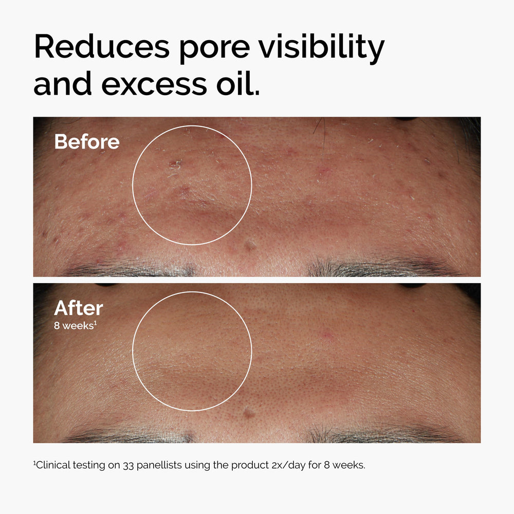 The Ordinary frascos de 1 fl oz en mano para referencia de tamaño