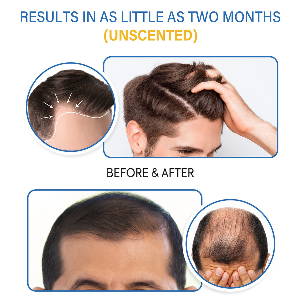 TOMUM etiqueta con ingredientes y concentración 5% minoxidil visible