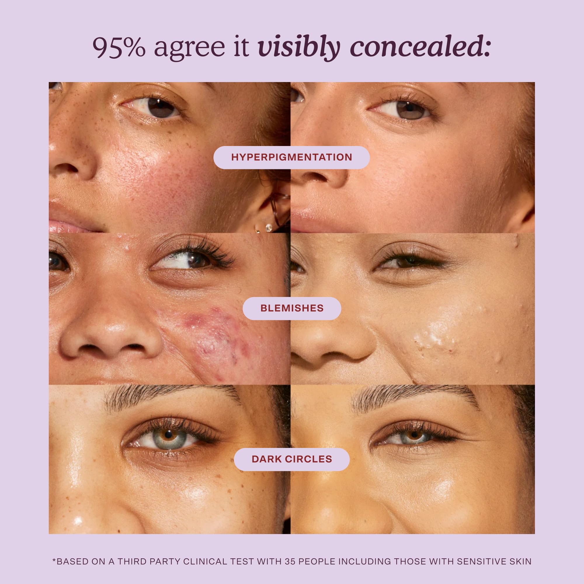Tower 28 before and after eye area showing coverage of dark circles and natural finish