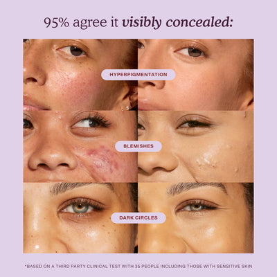 Tower 28 before and after eye area showing coverage of dark circles and natural finish