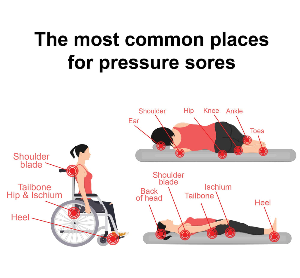 TriDerma being applied to shoulder area demonstrating caregiver use and friction reduction
