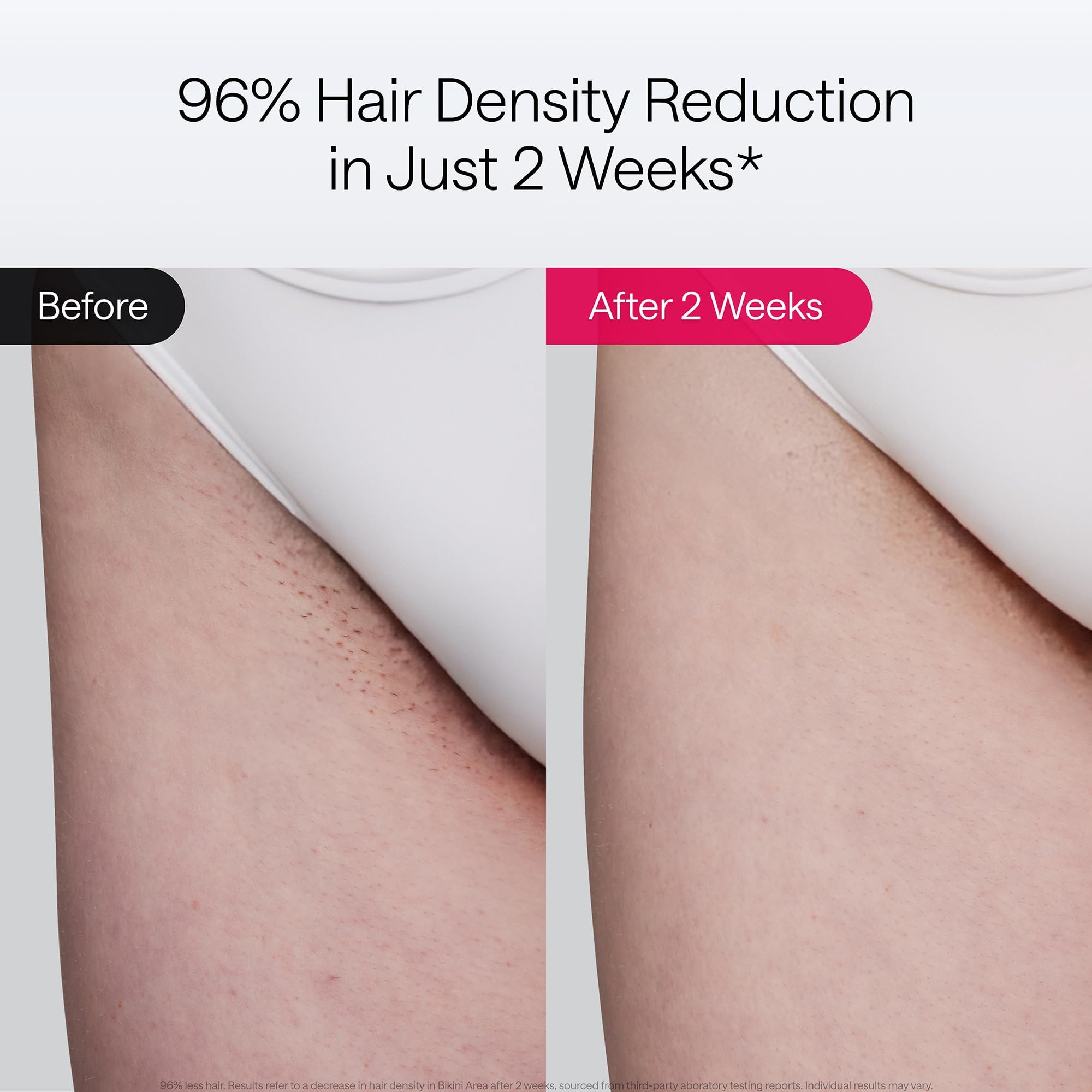 Ulike Air 10 primer plano lente de enfriamiento que reduce la incomodidad