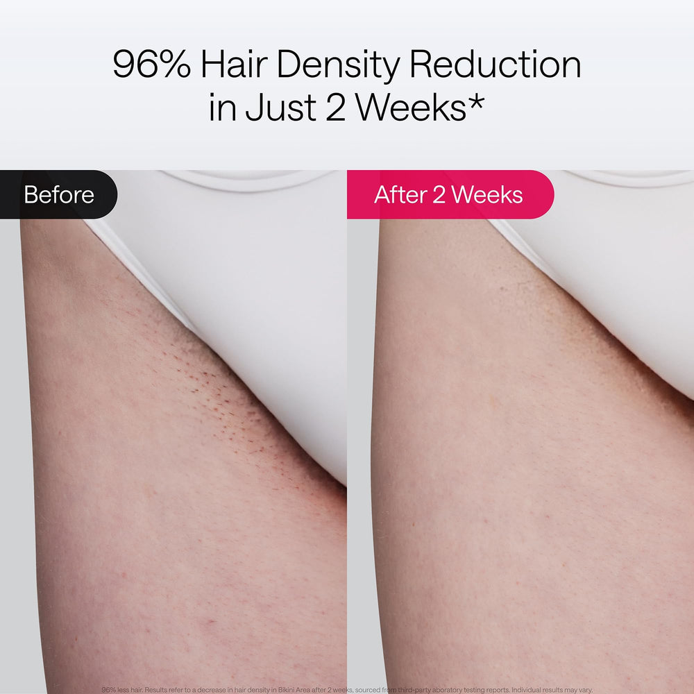 Ulike Air 10 primer plano lente de enfriamiento que reduce la incomodidad