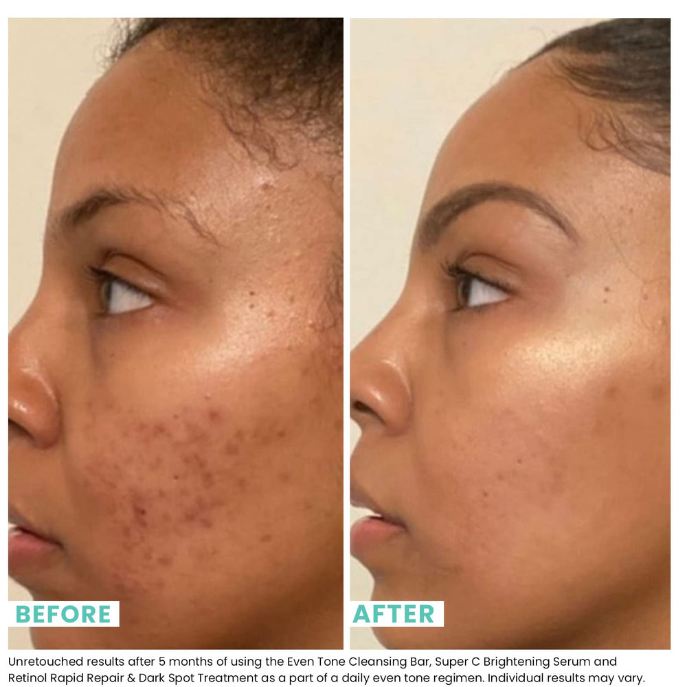 Urban Skin Rx detalle de la esponja exfoliante incluida, optimiza la aplicación uniforme