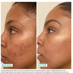 Urban Skin Rx detalle de la esponja exfoliante incluida, optimiza la aplicación uniforme