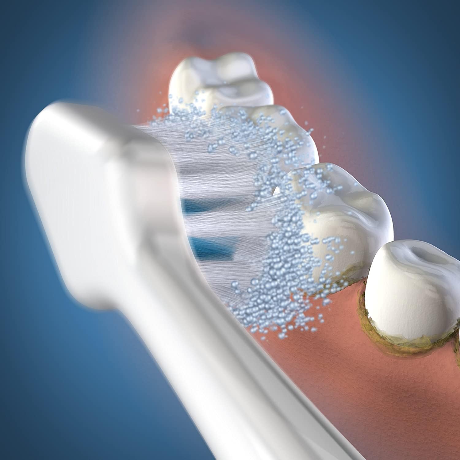 Waterpik vista del raspador de lengua en reverso para frescura
