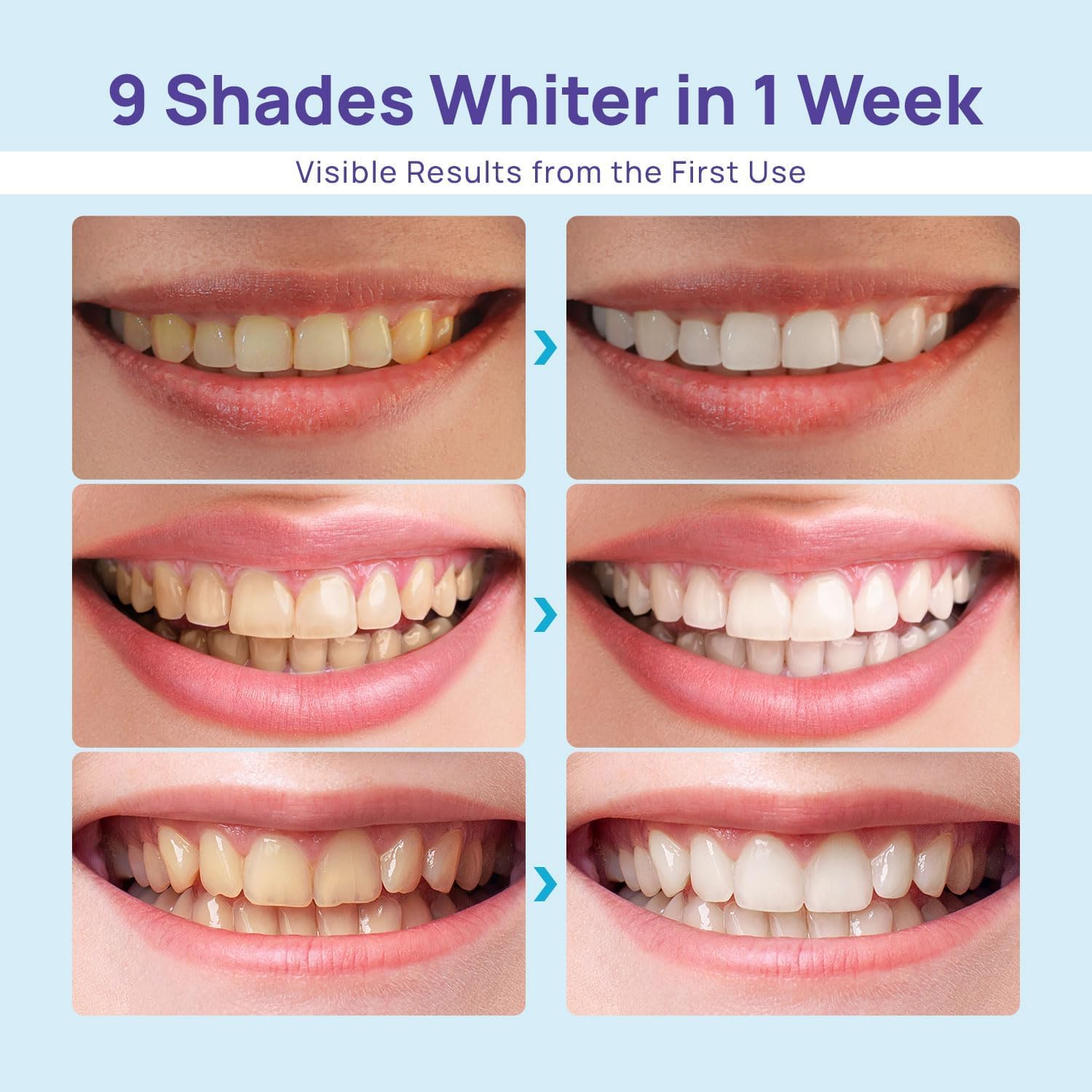 Whitebite Pro detalle de la bandeja bucal que asegura aplicación uniforme