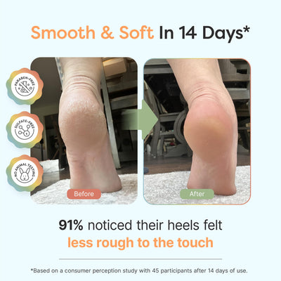 ZenToes textura cremosa en primer plano con absorción rápida